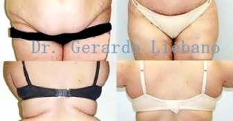 ¿Cirugía Plástica o Cirugía Estética?